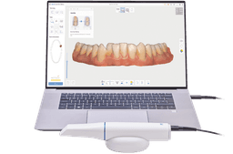 3D-Scan & Beratung